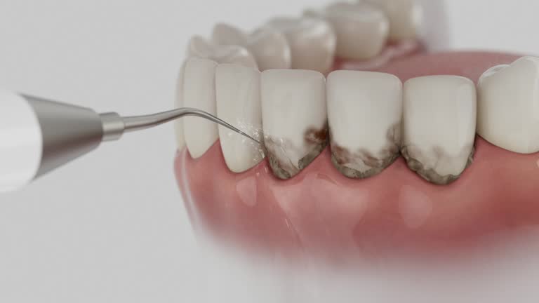 Trusted Emergency Dentist service in Point Clear, AL - Dentist Open Now